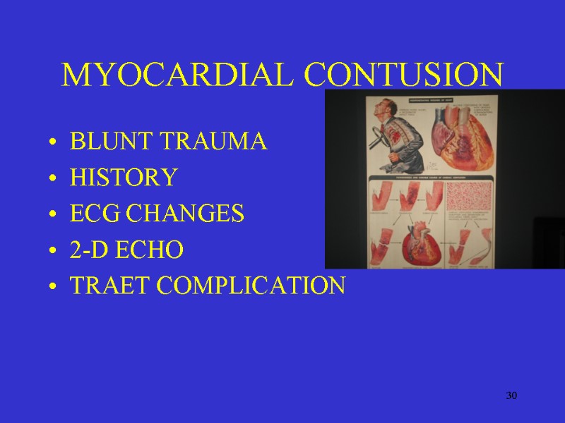 30 MYOCARDIAL CONTUSION BLUNT TRAUMA HISTORY ECG CHANGES 2-D ECHO TRAET COMPLICATION